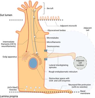 Tuft Cells and Their Role in Intestinal Diseases